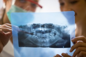 dental xrays and radiography