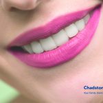 teeth straightening Melbourne