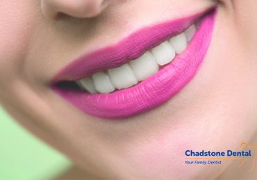 Blog 10 teeth straightening Melbourne