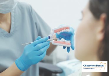 Blog 8 general dentistry services Chadstone Dental